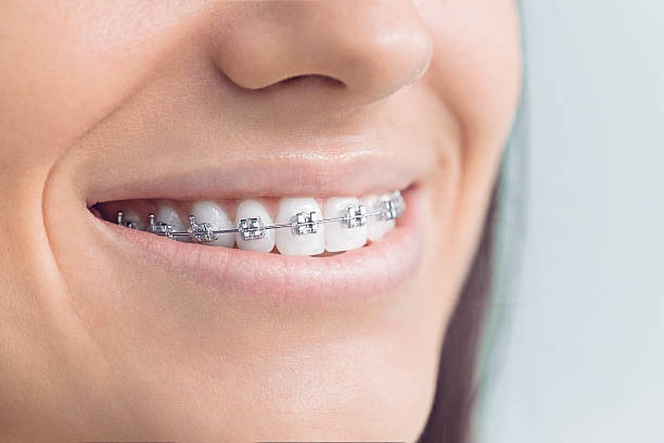 Best Wisdom Tooth Removal  in Ansted, WV